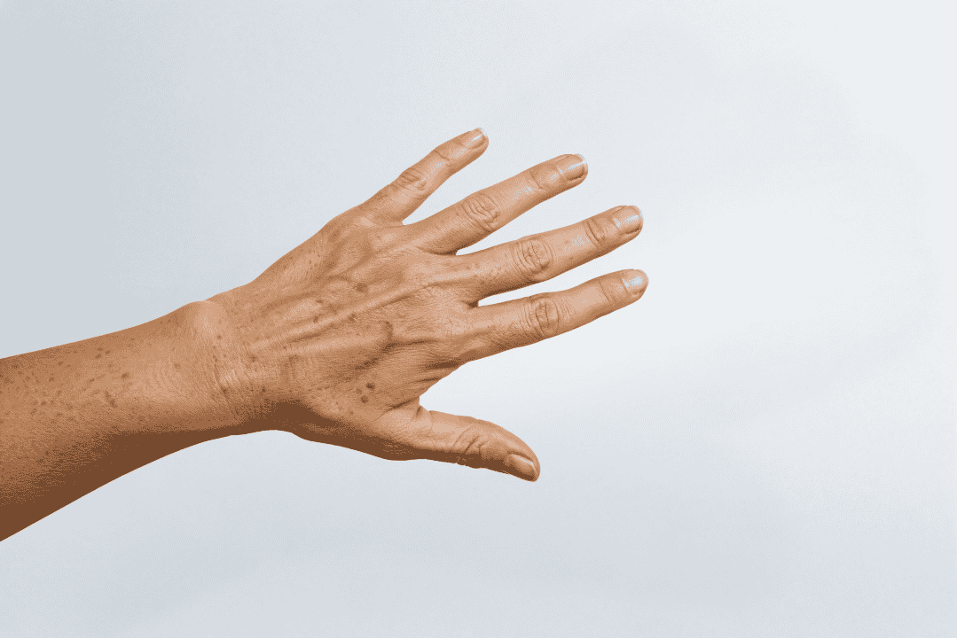 mano sobre fondo blanco con ligeras manchas marrones