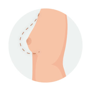 Ilustración de pecho femenino pequeño